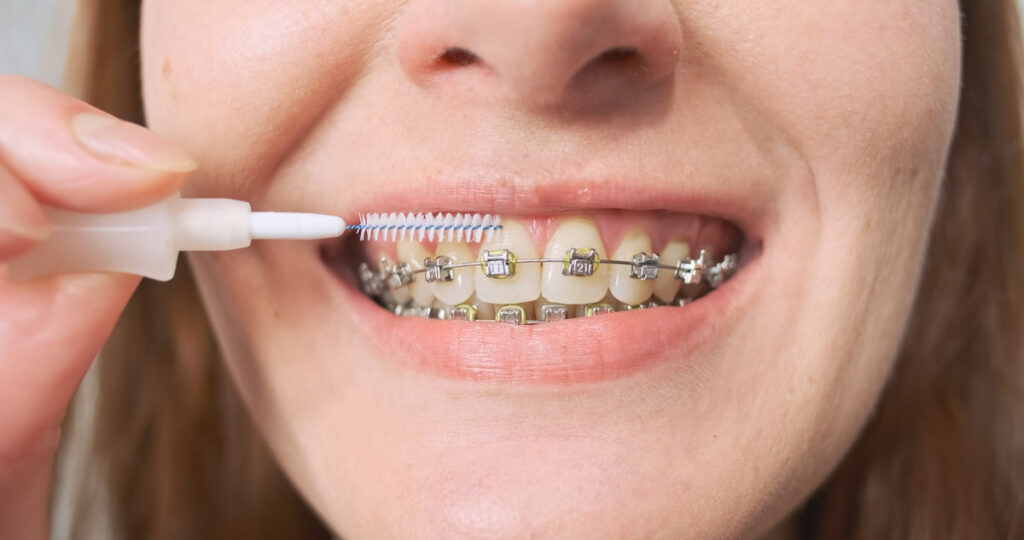 Woman brushes her teeth with metal briquettes using a toothbrush. Gentle cleaning of the teeth. Close-up, front view. High quality photo