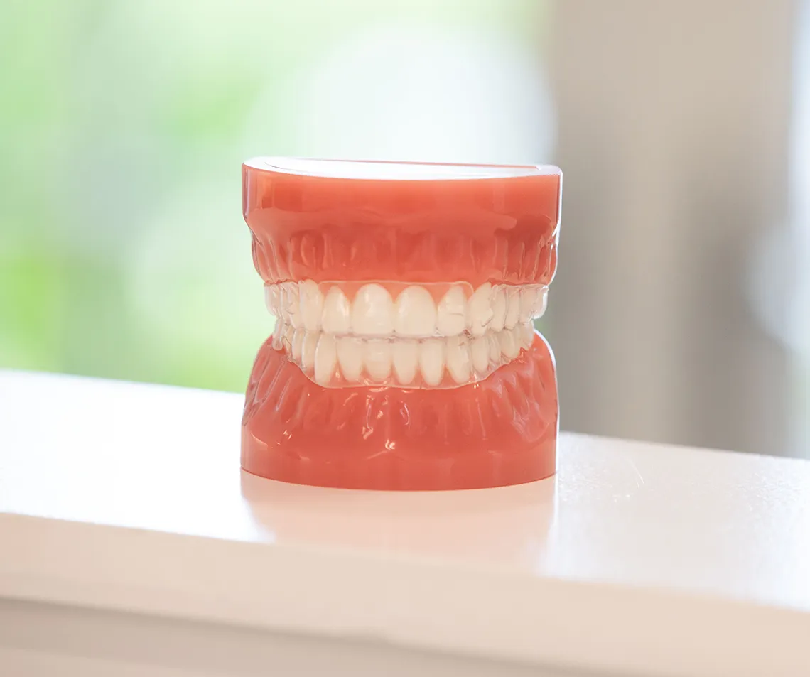 clear aligners