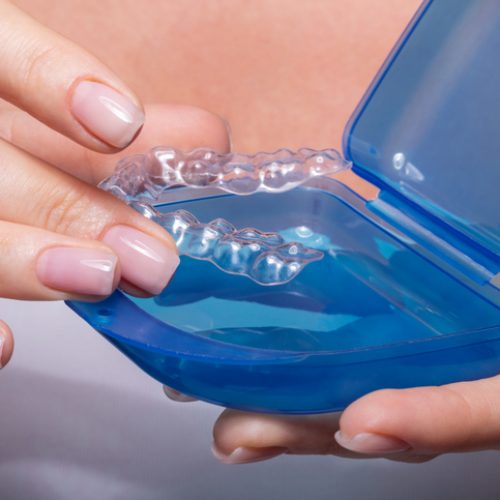 Woman's Hand Putting Transparent Aligner In Blue Case