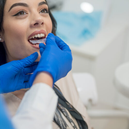 Dentist inserting orthodontic retainers, Nikon Z7