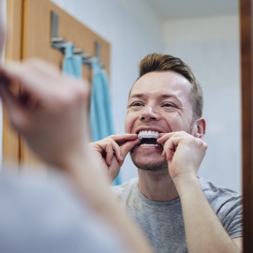 Young man preparing silicon tray for teeth whitening with bleaching gel. Themes dental health, care and beauty.