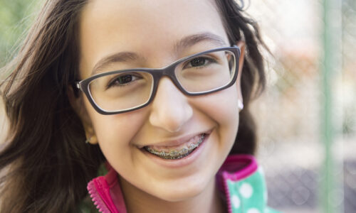 Close up portrait of a teenage girl with braces, outdoor portrait. Camera Nikon D800 36 Megapixel. Image developed from raw